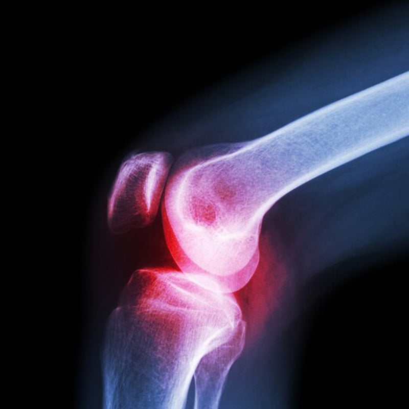 Knee Cap For Knee Support (Size-XL)